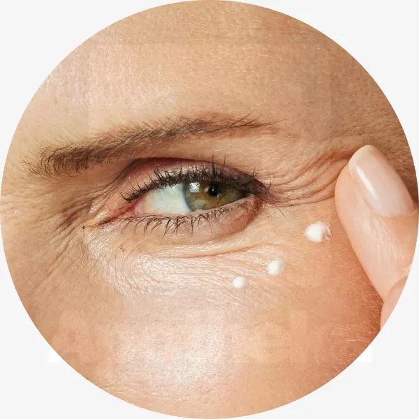 ISDIN SILMAÜMBRUSKREEM TURSEID LEEVENDAV K-OKSIIDIGA 15G - Tootepilt 4